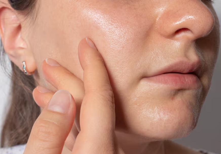 Understanding the Oily Skin Struggle of Blush Fades