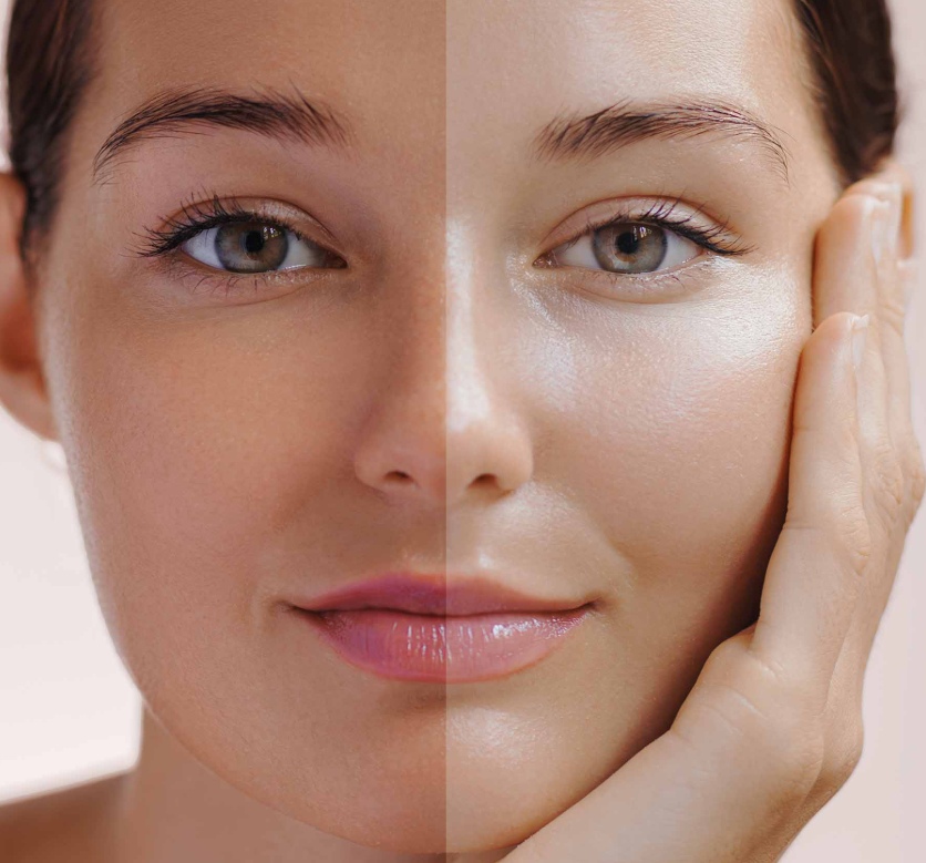 Daily Vitamin C care helps brighten skin and reduce dark spots